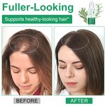 Hair Serum Manufacturer - ATOANY 20ml Roll on Rosemary Redensy Anagain Scalp Care