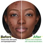 Soap Manufacturer - IKZEE African Black Soap 100g Organic Shea Acne Dark Spots Care