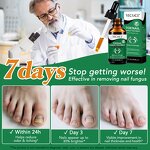 Nail Serum - Wholesale Private Label Toenail Fungus Extra Strength Repair