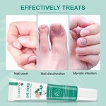 Nail Serum - 30ml Natural Anti Fungal Nail Repair Essence Oil Treatment