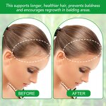 Batana Oil - YECUCE Honduras 100% Raw Cold Pressed Organic Hair Growth