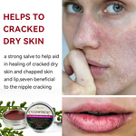 Comfrey Salve Manufacturer - Organic for Wounds, Rashes & Arthritis