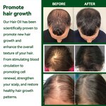 Hair Growth Serum Manufacturer - Natural Customized Anti Hair Loss Oil
