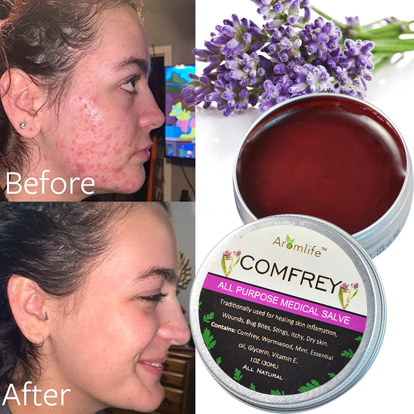 Comfrey Salve Manufacturer - Organic Herbal Extract Ointment for Relief