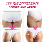 BBL Gummies Manufacturer - Custom Body Lifting & Hip Boost Vegan