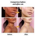 Multi Collagen Capsules Manufacturer - with Biotin Peptides Types I, II, III, V, X