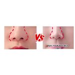 Nasal Shaping Strips Manufacturer - Keto-life Small Self-Adhesive Elastic for Nose Correction