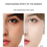 Gold Peptide Kit Manufacturer - GPT Face Absorbable Collagen Protein Thread Lift