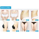 Body Slimming Roller Manufacturer - 9D Rotation 2 in 1 Inner Ball Lymphatic Drainage Vacuum