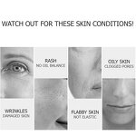 Gold Peptide Kit Manufacturer - GPT Face Absorbable Collagen Protein Thread Lift