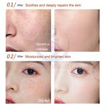 Hyaluronic Acid Ampoule - Manufacturer - Pure Serum Skin Rejuvenation Face Care