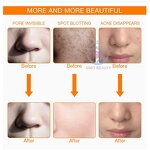 Wrinkle Reduction Mask - Manufacturer - LabVerified Energy-focused Bedtime Ritual