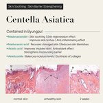 PDRN Solution - Manufacturer - Human Stem Cells 20000 Spa Moisturizing Low Price