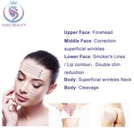 Hyaluronic Acid Thread - Manufacturer - Eyebrow Lift 5000+ Clinic Verified Dissolving