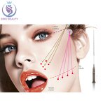 PDO Thread Lift - Manufacturer - Korean Medical 30g Blunt Needle for Eyes