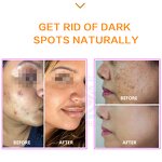 Collagen Ampoules - Manufacturer - Vitamin E Ferulic Acid Hyaluronic Acid Low Price