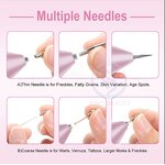 Plasma Pen - Manufacturer - Professional Premium Beauty Skin Tag Removal High Quality