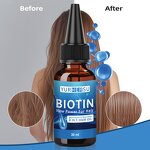 Biotin Hair Oil - Manufacturer - 3-in-1 Hair Loss Prevention Nourishing Essential Oil