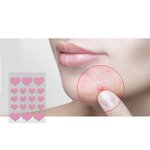 Acne Patches - Manufacturer - Ultra-Thin Hydrocolloid Disposable Spot Stickers