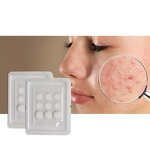 Acne Patches - Manufacturer - Hydrocolloid Dissolving Microcrystal Pimple Zits