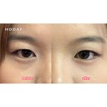 Micro Dart Eye Patches - Manufacturer - Vitamin C Hyaluronic Acid Brightening Dark Circles