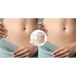 Silicone Scar Strips - Manufacturer - Reusable Self-Adhesive C-Section Scar Tape