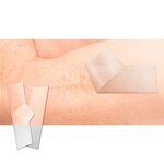 Silicone Scar Strips - Manufacturer - Reusable Self-Adhesive C-Section Scar Tape