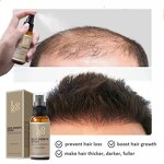 Hair Growth Oil - Manufacturer - China Organic Anti-Dandruff Refreshing Hair Loss Repair