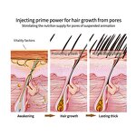 Hair Growth Oil - Manufacturer - China Organic Anti-Dandruff Refreshing Hair Loss Repair