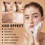 Lemon Turmeric Soap - Manufacturer - Wholesale Handmade Organic Dark Spots Remover Deep Cleansing