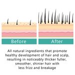 Hair Regrowth Serum - Manufacturer - Private Label Restoration Baldness Thinning Hair Fall Repair