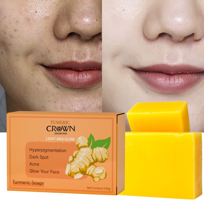 Turmeric Soap - Manufacturer - Wholesale Natural Organic Anti Aging Acne Lightening Peeling Glow