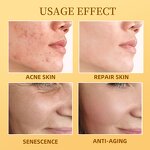 Bee Venom Face Cream - Manufacturer - Private Label Firming Brightening Anti Aging Acne Repair