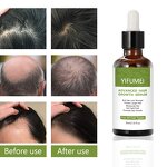 Scalp Care Hair Serum - Manufacturer - Private Label Best Repair Moisturized Anti Hair Loss Growth
