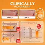 Kojic Acid Soap - Manufacturer - Custom Logo Brightening Pigmentation Dark Spots Skin Lightening