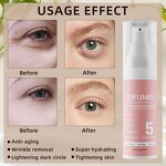 5 in 1 Eye Cream - Manufacturer - Private Label Brightening Eye Bag Remover Firming Lifting Anti Wrinkle