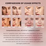 Face Cream - Manufacturer - 8 in 1 Natural Moisturizing Dark Spot Remover Anti Aging Whitening