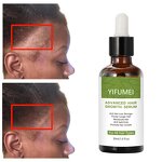 Scalp Care Hair Serum - Manufacturer - Private Label Best Repair Moisturized Anti Hair Loss Growth