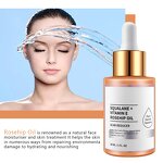 Rosehip Seed Skin Oil - Manufacturer - Stretch Mark Repair Antioxidant Anti-Aging Vitamin E