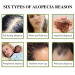 Scalp Care Hair Serum - Manufacturer - Private Label Best Repair Moisturized Anti Hair Loss Growth