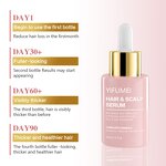 Rosemary Hair Oil - Manufacturer - Private Label Anti Loss Regrowth Hair Growth Treatments Serum