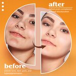 Kojic Acid Soap - Manufacturer - Wholesale Natural Turmeric Dark Spot Corrector Skin Whitening