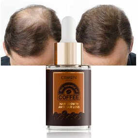 Caffeine Hair Growth Oil - Manufacturer - Private Label 100% Natural Scalp Care Anti Loss Regrowth