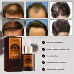 Caffeine Hair Growth Oil - Manufacturer - Private Label 100% Natural Scalp Care Anti Loss Regrowth