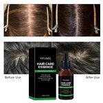 Ginger Hair Growth Serum - Manufacturer - Private Label Natural Organic Anti-Loss Regrowth Scalp Care