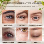 5 in 1 Eye Cream - Manufacturer - Private Label Caffeine Vitamin C Brightening Anti Puffiness Anti Aging