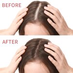 Rosemary Hair Growth Serum - Manufacturer - Private Label Organic Anti Loss Regrowth Repair Oil