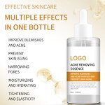 Salicylic Acid Serum - Manufacturer - Private Label Lightening Dark Spot Whitening Anti Acne Exfoliating