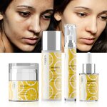 Whitening Skin Care Set - Manufacturer - Private Label 7 Days Advanced Kojic Acid Vitamin C
