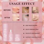 Facial Skin Care Set - Manufacturer - Private Label Niacinamide Retinol Rose Toner Brightening